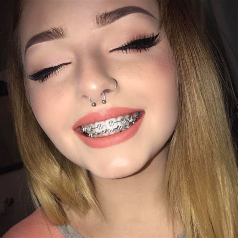 braces girl leaked|r/bracesgirl5